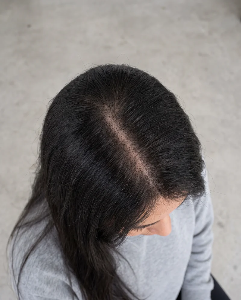Cabello oscuro con la raya al centro y más densidad a lo largo de ella (imagen ilustrativa)