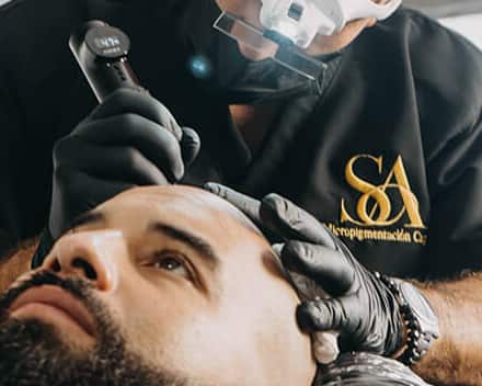 Manos de Santiago Abril con guantes negros y el dermógrafo, trabajando sobre la línea frontal de un paciente